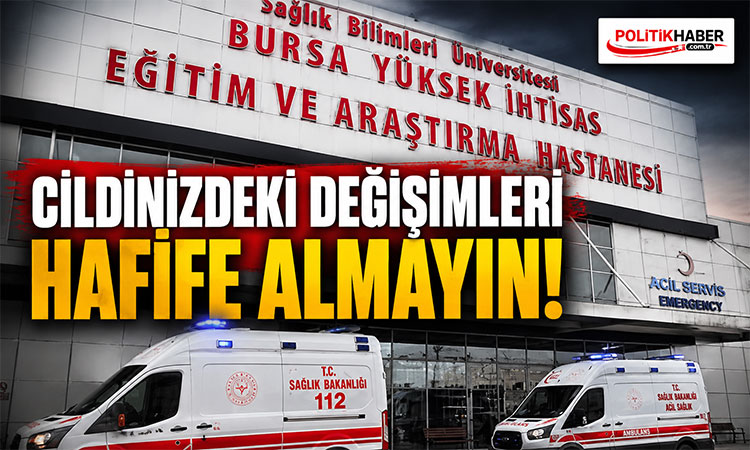 Cildinizdeki değişimleri önemseyin!