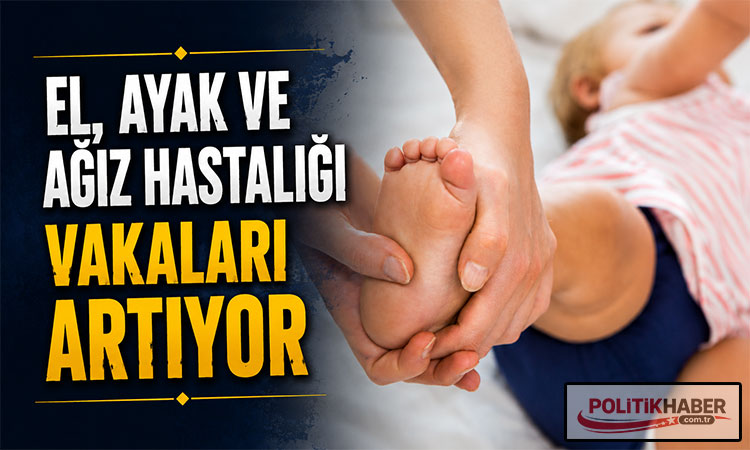 El, ayak ve ağız hastalığı vakaları artıyor